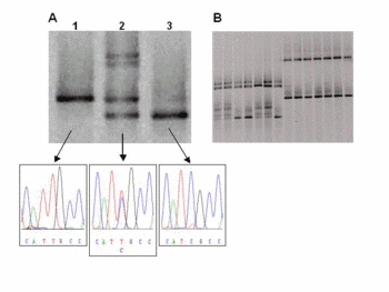 Mutationsscreening mit Denaturierendender Gradientengelelktrophorese (DGGE)